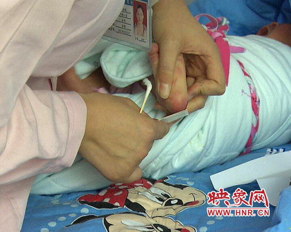 醫(yī)護(hù)人員在為一名新出生嬰兒采足跟血，做疾病篩查