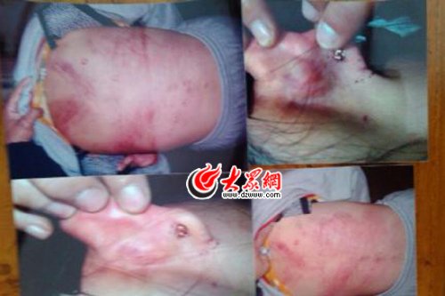 　山東藝術(shù)設(shè)計學院16歲女生宿舍內(nèi)被女同學暴打4小時。