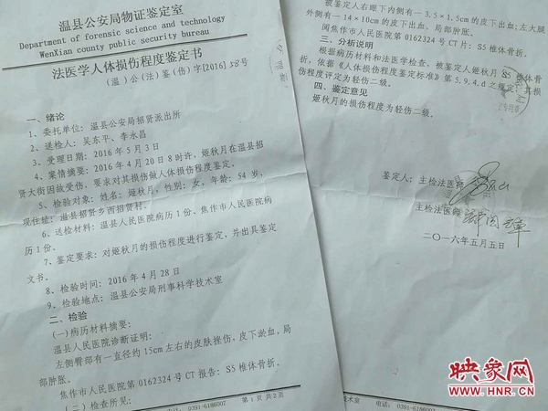 傷情司法鑒定為二級輕傷