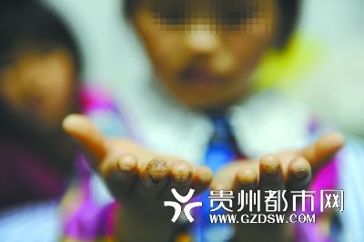 指尖被針扎得傷痕累累。