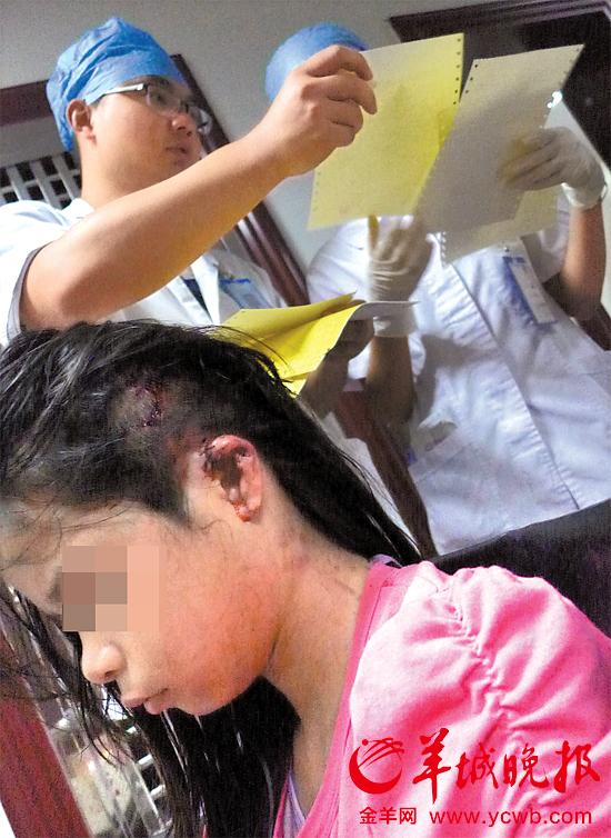 受傷的11歲女孩頭發(fā)被卷入扶梯，耳朵被嚴(yán)重拉傷，需手術(shù)。