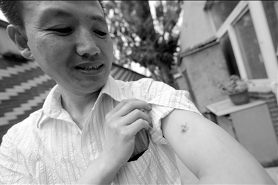 郭學(xué)江制服狂徒時被咬傷。京華時報記者潘之望攝
