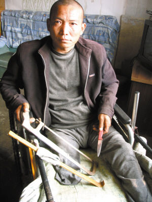 鄭艷良就是用這幾樣簡陋工具，給自己做了右腿截肢手術(shù)。