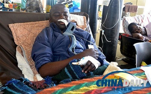 雖然已經(jīng)在醫(yī)院接受了近一個(gè)月的恢復(fù)治療，卡托卡的身體仍然非常虛弱。