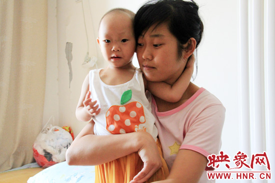 孩子和媽媽在一起，她的右眼已經(jīng)失明。