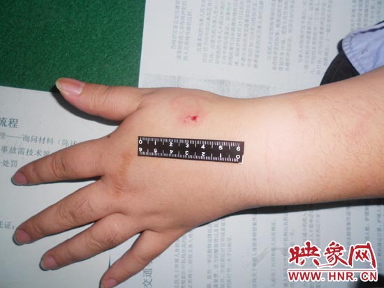 為幫助無證駕駛的朋友逃避處罰，新鄉(xiāng)的王某竟對(duì)執(zhí)勤民警大打出手，還將一名民警的手臂咬傷