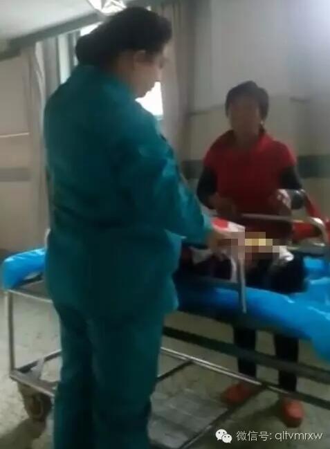 涵涵爸爸告訴《每日新聞》記者：“沒想到是熱水，大人也沒看，一時(shí)疏忽，掉進(jìn)去了。抱出來的時(shí)候這個(gè)皮已經(jīng)掉了。”