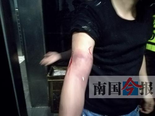 覃先生手臂被卡的部位受傷流血，所幸傷勢(shì)無(wú)大礙。 通訊員 王建民 攝