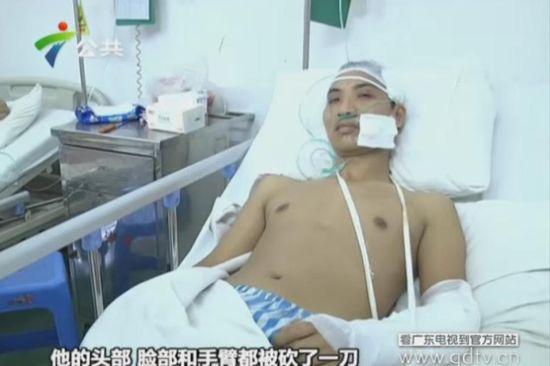 另一名傷者頭部、臉部和手臂都被砍了一刀。(視頻截圖)
