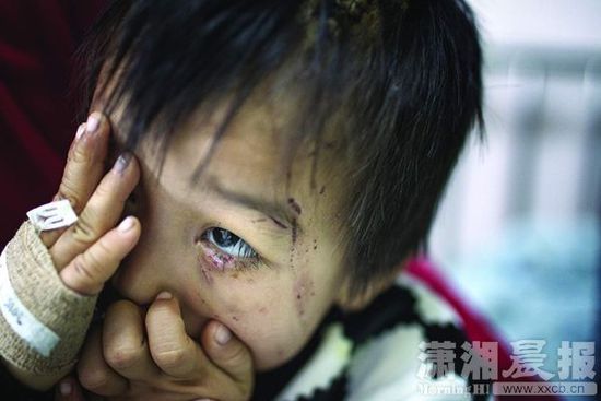 1月13日，湖南省兒童醫(yī)院，4歲的源源用手蒙住了眼睛。