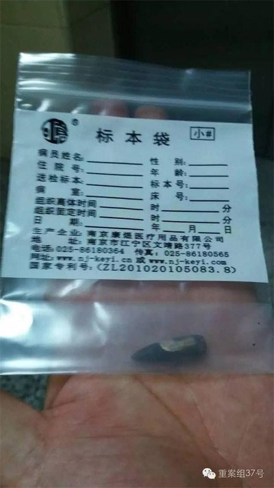 經(jīng)警方鑒定，秦女士體內(nèi)取出的子彈系56式步槍射出 。 受訪者供圖