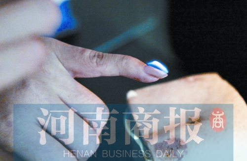 將指甲油涂在指甲上，靠近火焰時被引燃了