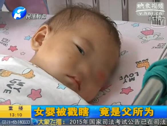 女?huà)氡桓赣H用筷子戳瞎眼