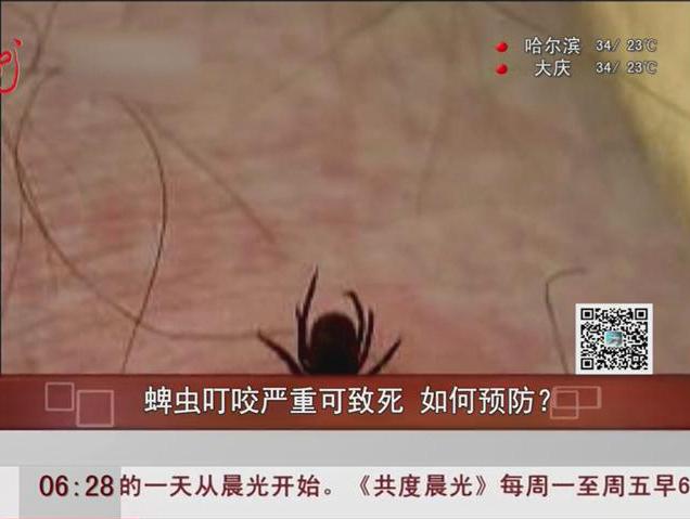 蜱蟲叮咬嚴(yán)重可致死如何預(yù)防？